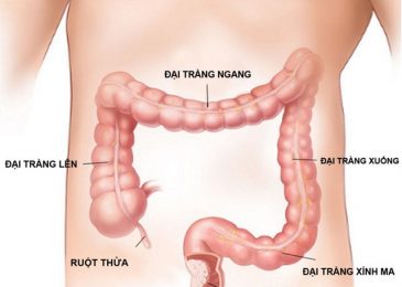 Đau bụng dưới bị bệnh gì 8 Đau bụng dưới bị bệnh gì