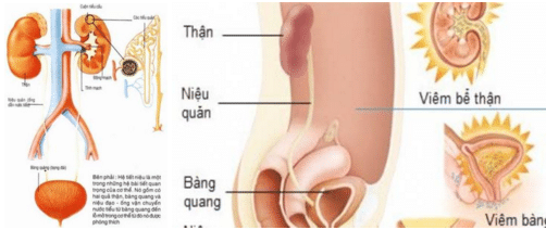 Đau bụng dưới bên trái bị bệnh gì 6 Đau bụng dưới bên trái bị bệnh gì